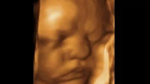 Fetal Memories 2D 3D 4D Ultrasound